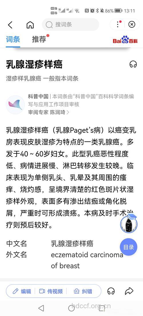 湿疹样乳腺癌有什么发病特点