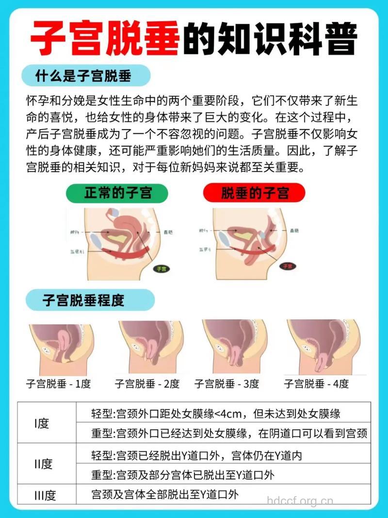 子宫脱垂为何偏爱老年妇女？