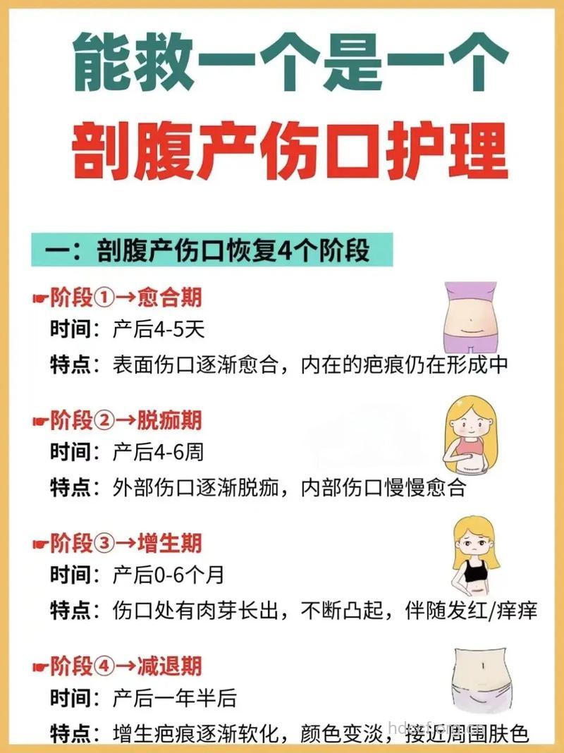 产后伤口发炎别着急 术后护理很重要