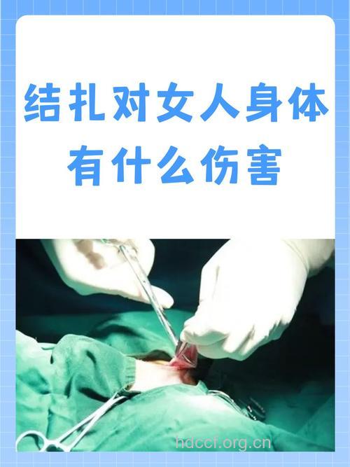 结扎手术有八大危害 女性不可不知