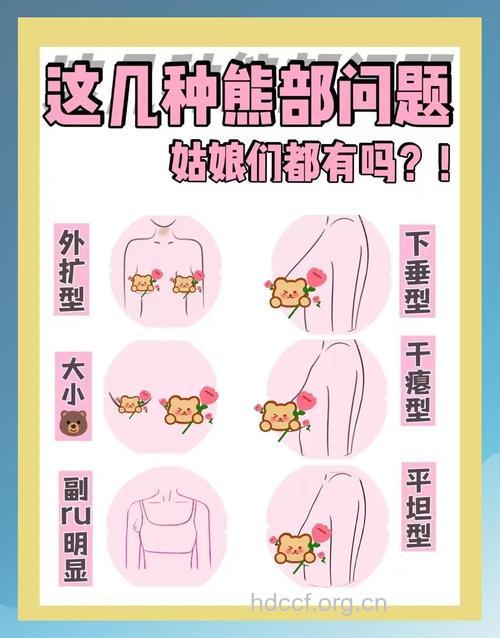 以下乳房不适，你重视过吗？