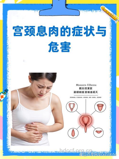 宫颈息肉的危害有哪些