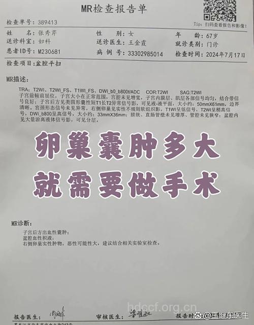 卵巢囊肿多大需要手术?卵巢囊肿大小为5厘米