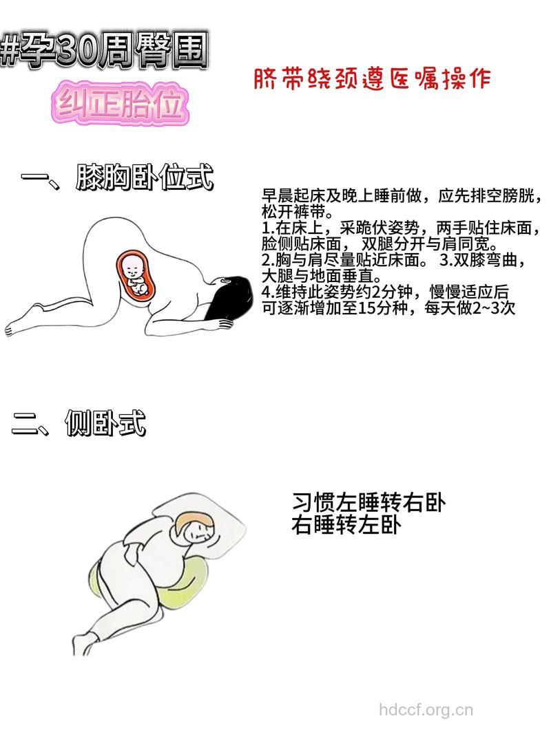 胎位不正的4个纠正方法