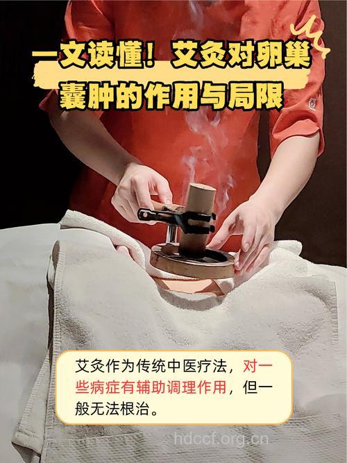 卵巢囊肿可以艾灸吗？只限于比较小的囊肿