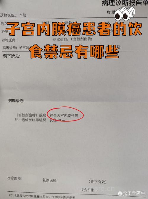 子宫内膜癌饮食有哪些禁忌