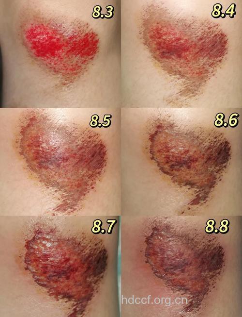 女性长期骑自行车 私处伤不起