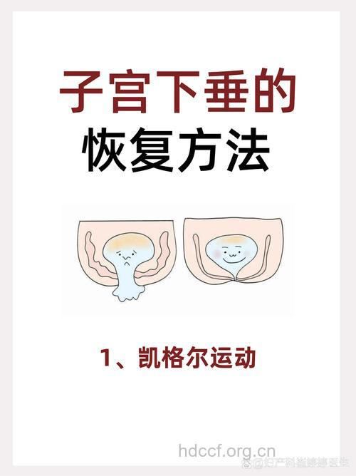 产后急于塑身当心子宫下垂