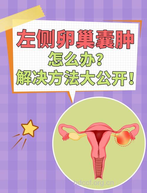 左侧卵巢囊肿的原因 5个原因早知道