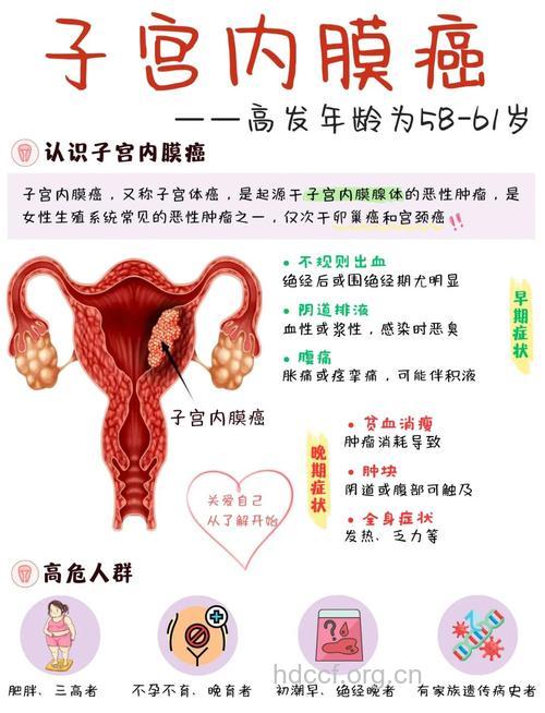 哪些女性易得子宫内膜癌