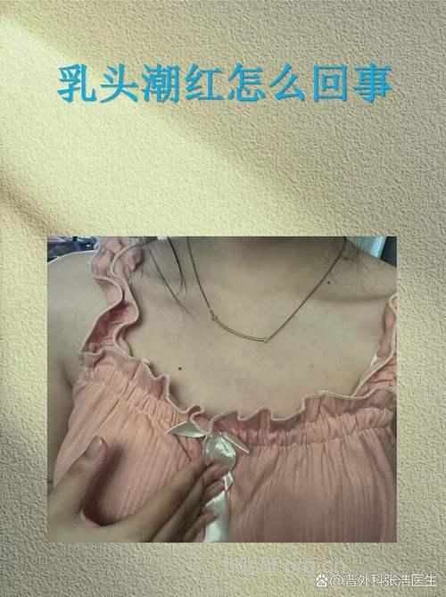 女性乳头为什么会变色 真相竟是这样