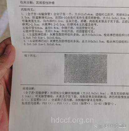 子宫癌治愈率有多大