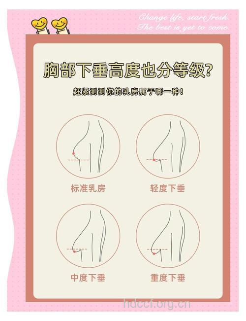 乳房下垂的原因及预防方法