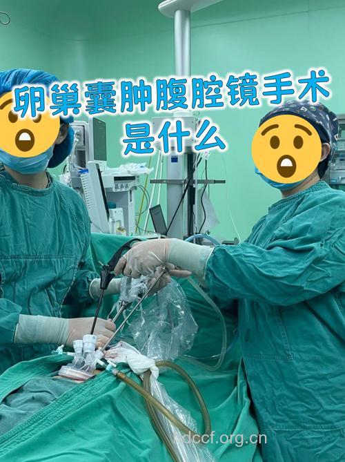 右卵巢囊肿手术治疗 分三种手术方式