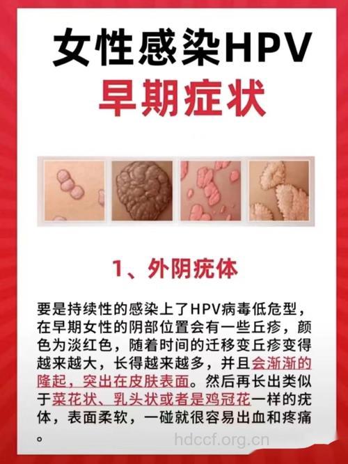 早期宫颈癌的症状是什么