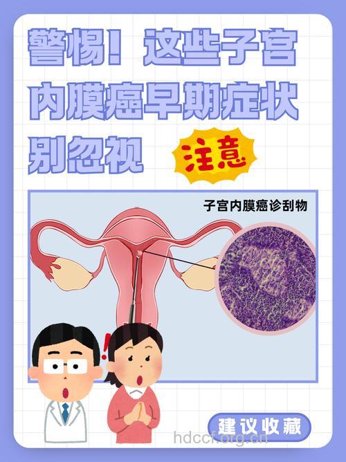 8种女人易招惹子宫内膜癌