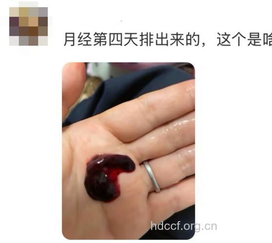 经血中出现血块是正常现象吗