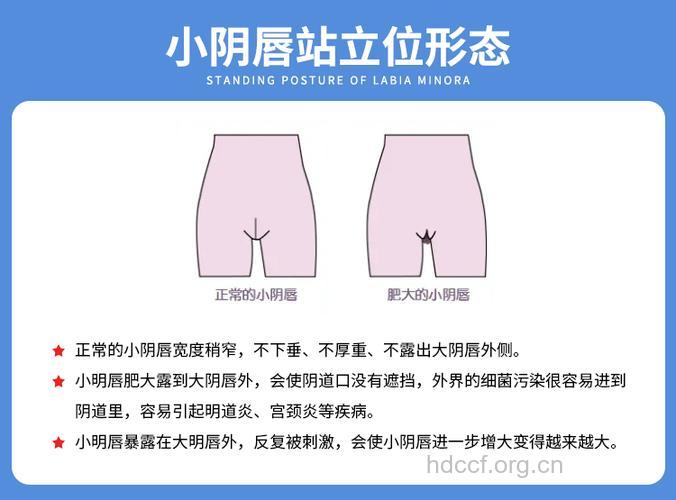 女人私处最害怕四个烦恼！