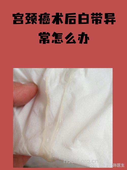 白带水样化提防子宫内膜癌