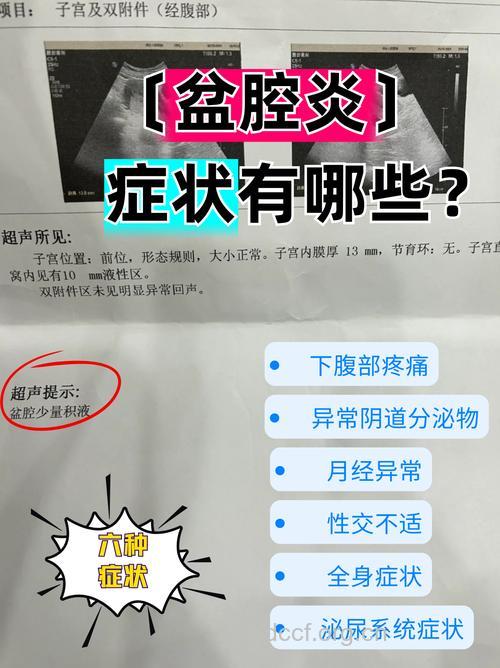 慢性附件炎出现的三大症状