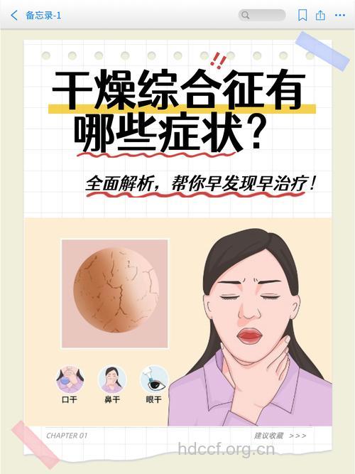 中年女性注意干燥综合症6个症状