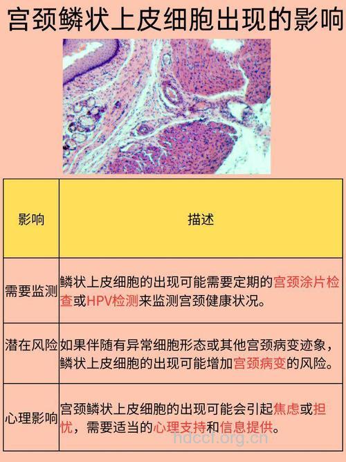 宫颈癌病与涂片有什么关系
