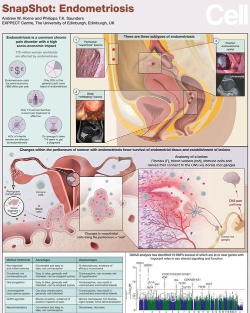 子宫内膜异位症的主要病理变化