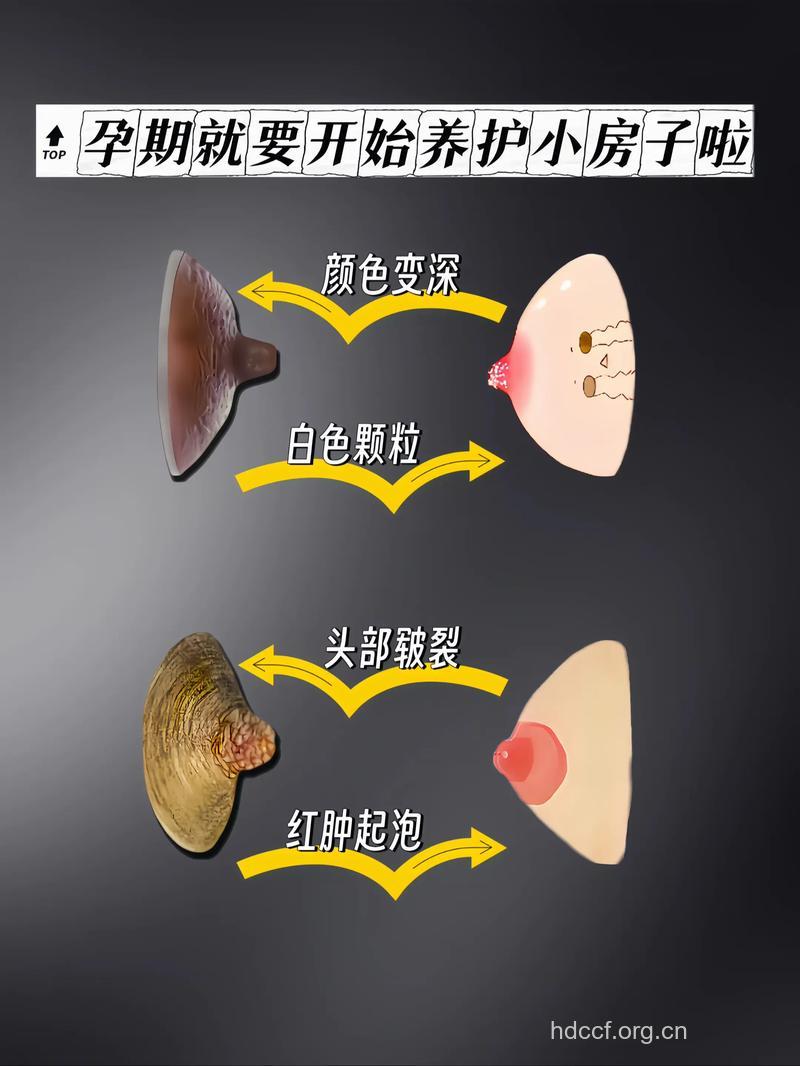 隆胸后哺乳 乳液是否含毒？