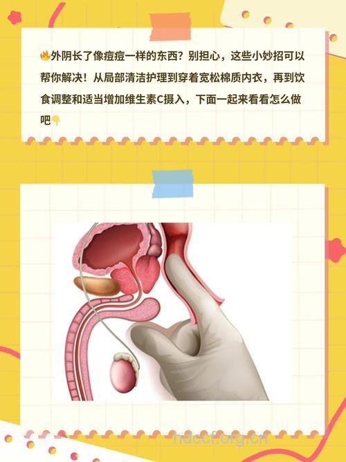 女性外阴为什么会长痘 女性如何护理阴道