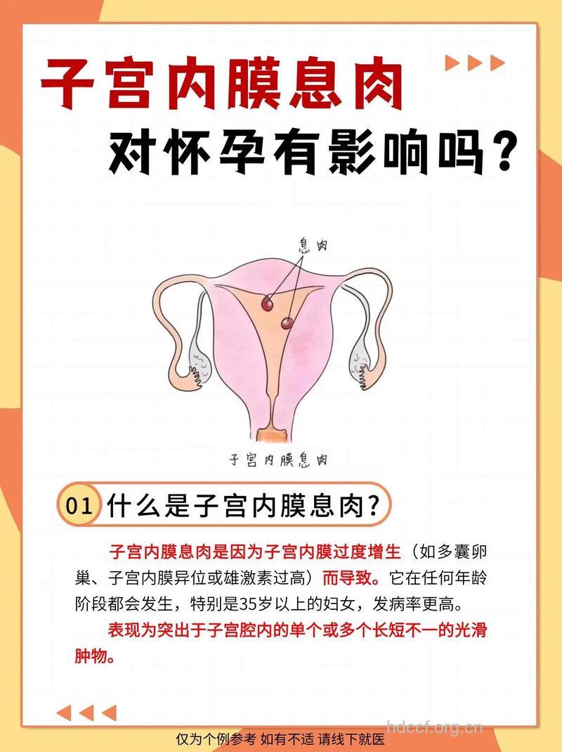 子宫内膜息肉影响怀孕吗
