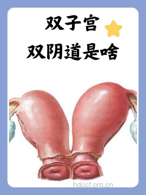 双子宫是怎么回事 是子宫重复性发育异常