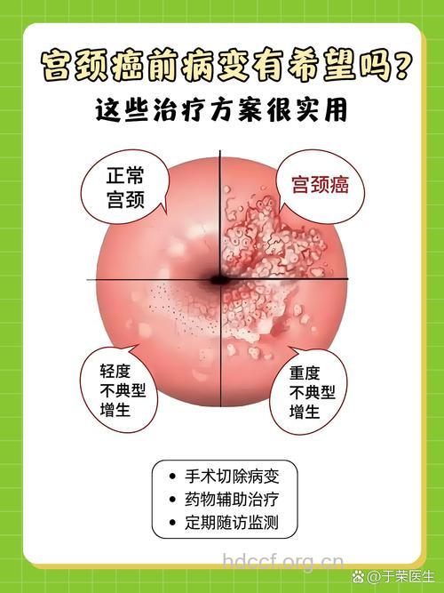 孕妇子宫颈早期癌变怎么办