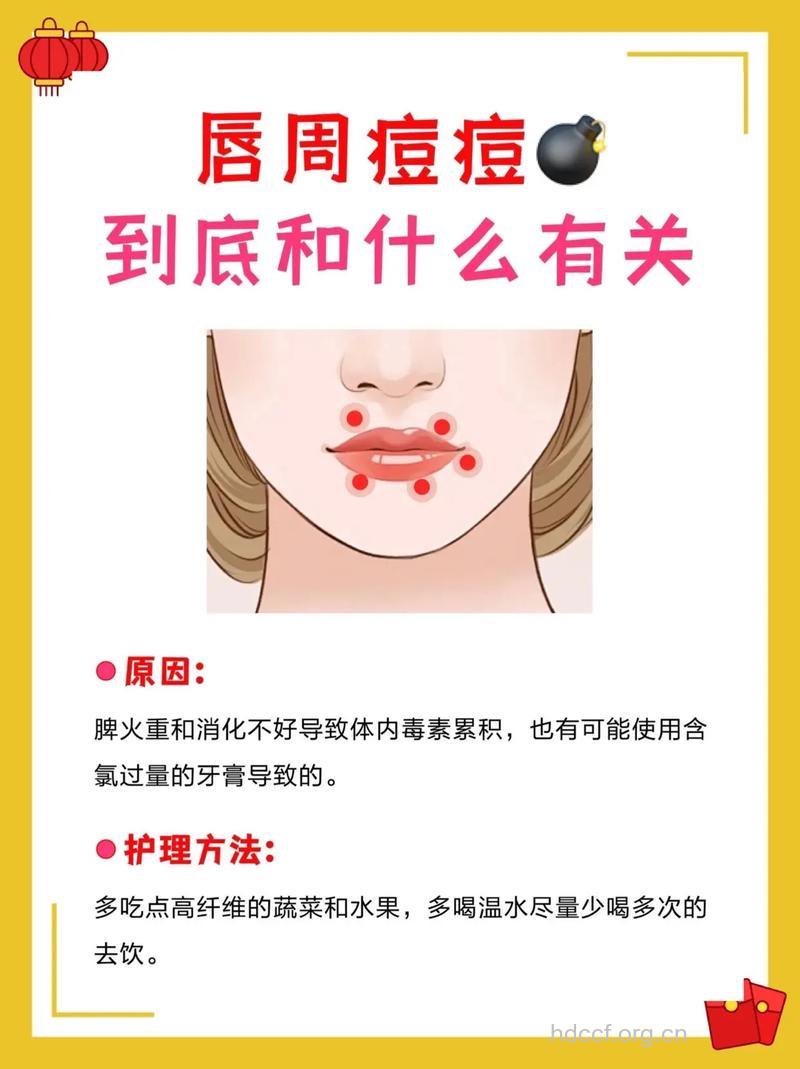 嘴巴周围长痘痘的原因与祛痘方法