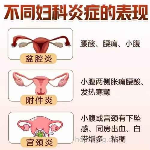 附件炎的常见的诱因是哪些