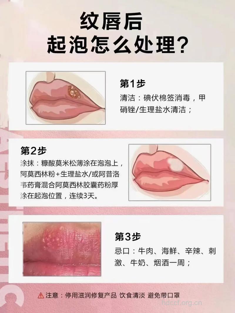 女人唇边长水疱是怎么回事