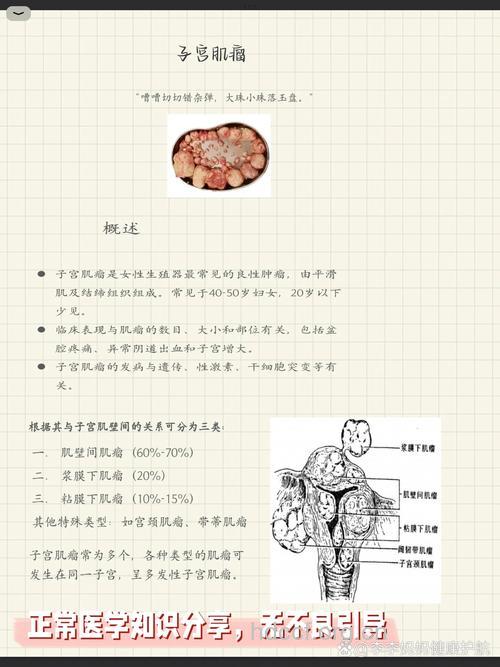 子宫肉瘤的诊断方法有哪些