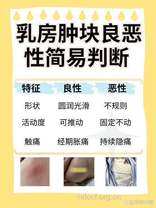 乳房有能推动的肿块是怎么回事