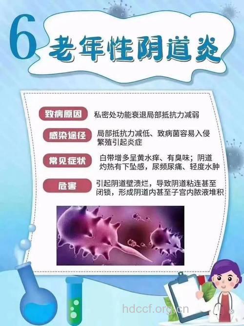 女性做好5点防阴道炎