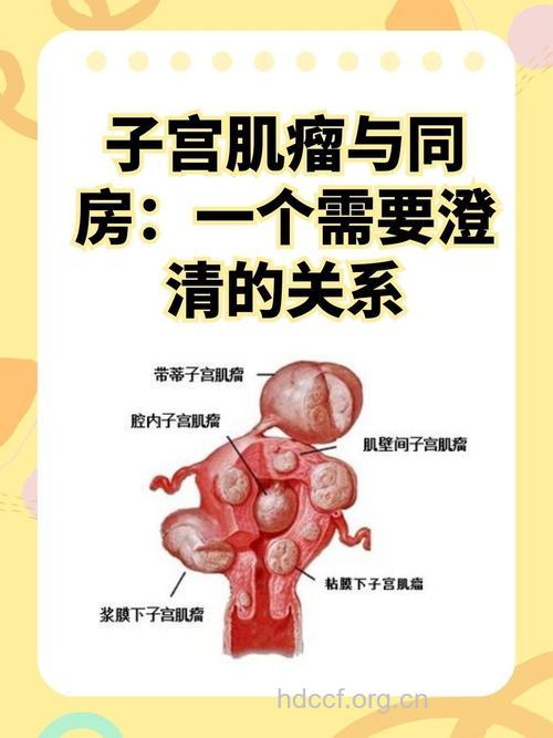 子宫瘤危害夫妻生活
