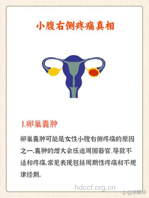 腹痛是卵巢囊肿的常见症状