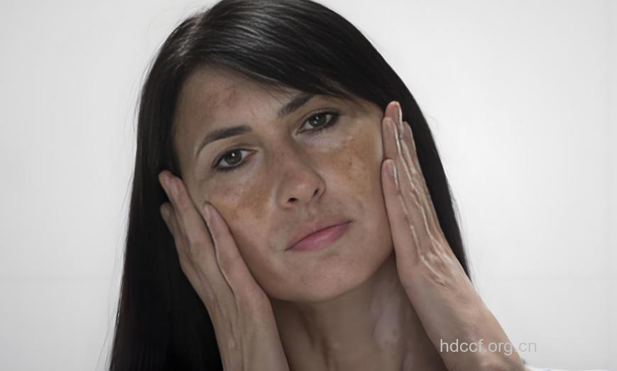 女性为什么经常脸色差