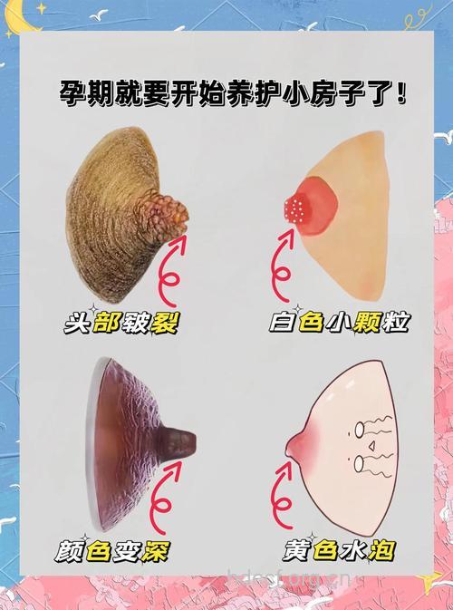 乳头皲裂有什么症状