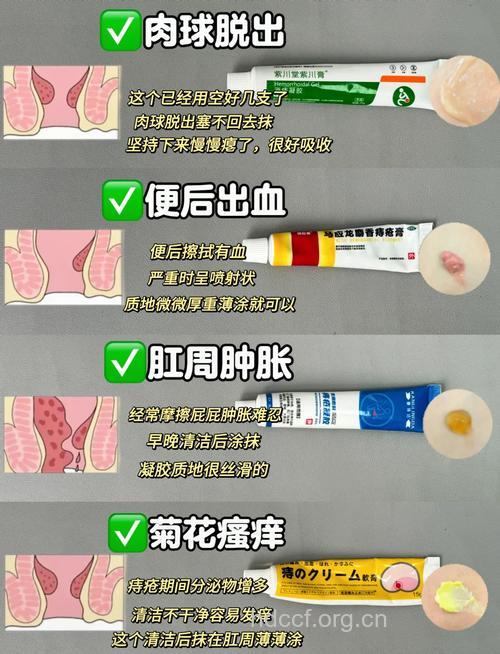 孕妇能用痔疮膏吗