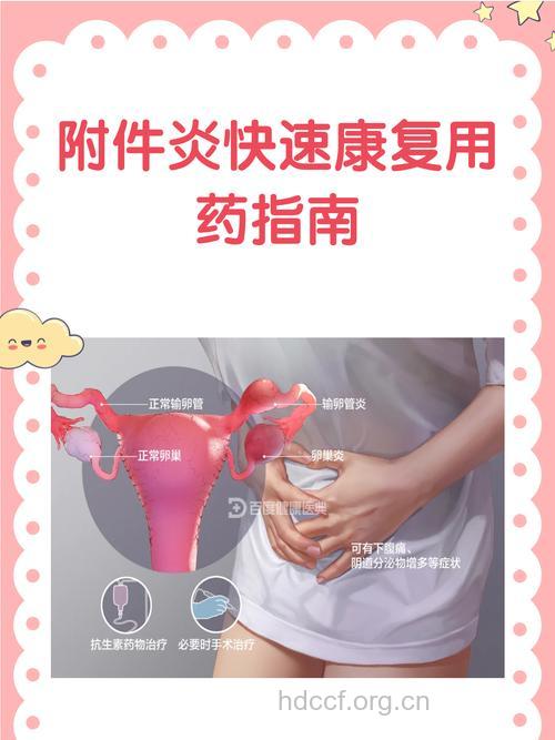 防治附件炎的方法有哪些