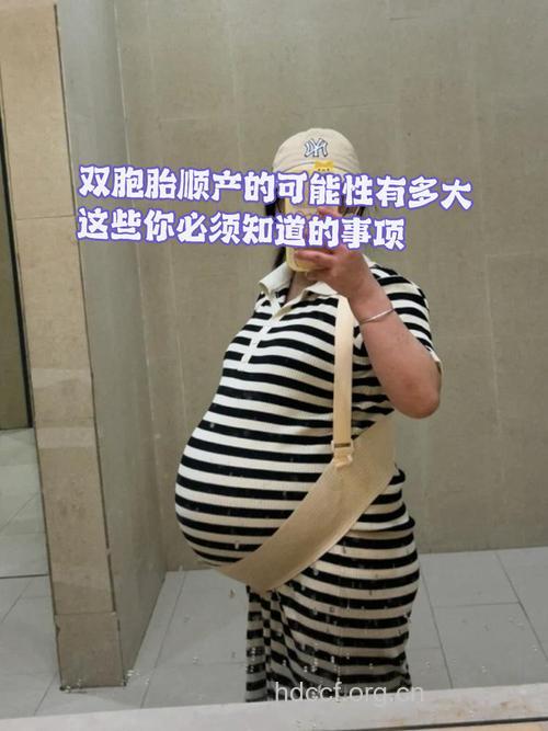 双胞胎能顺产吗