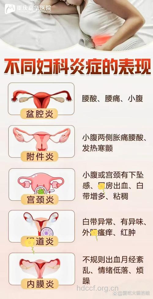 盆腔炎发病的重要时期