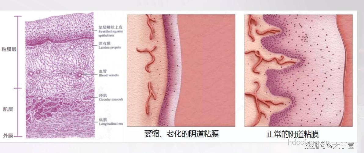 缺乏维生素B2阴道会干涩