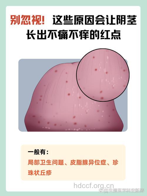 性爱时皮肤变红是怎么回事