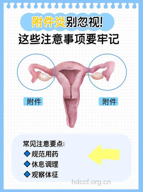 预防附件炎的日常须知