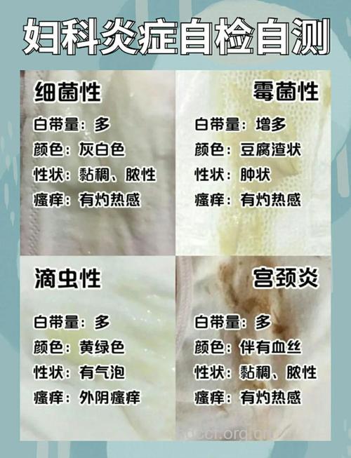 妇科霉菌到处都是 妇女们要保护自己不被侵袭